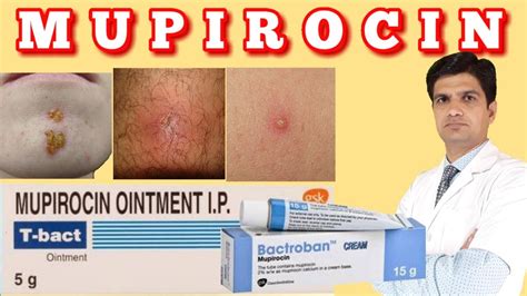 Mupirocin Benefits