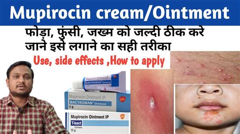 Mupirocin Ointment Side Effects