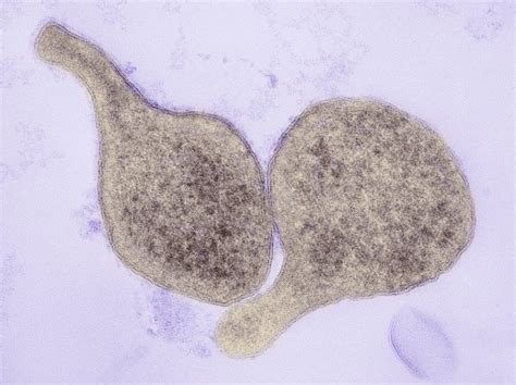Mycoplasma Genitalium Infection Causes