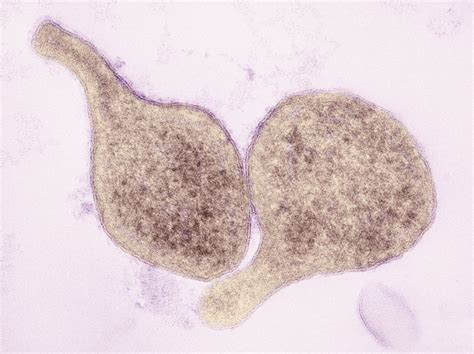 Mycoplasma Genitalium Infection Home Remedies