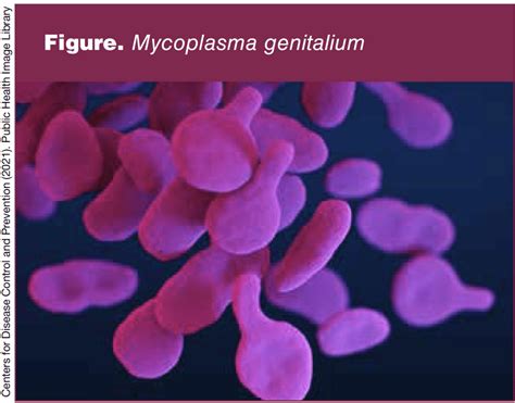 Mycoplasma Genitalium Infection in Women