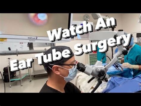 Myringotomy Ear Tube Surgery