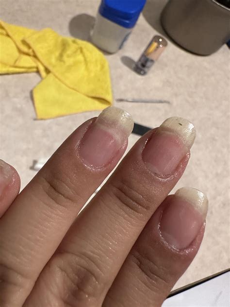 Nail bed damage