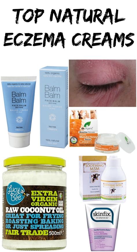 natural alternatives to eczema medication cream