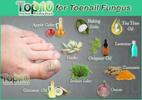 Natural Remedies for Toenail Health