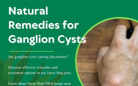 natural remedies for ganglion cysts