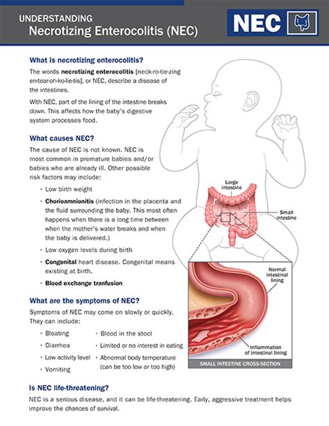 Necrotizing Enterocolitis Causes