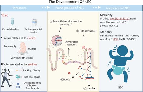 Necrotizing Enterocolitis Prevention
