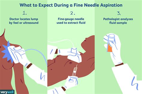 Benefits of Needle Biopsy