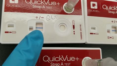 Negative Strep Screen Test Results