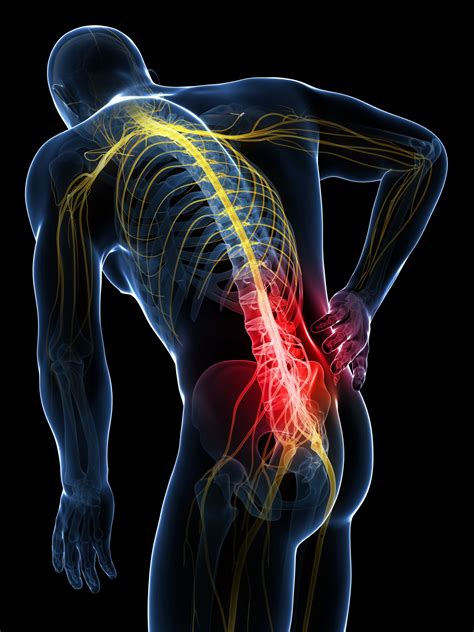 Nerve pain management