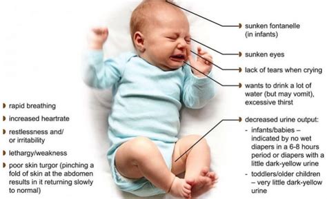 newborn dehydration causes