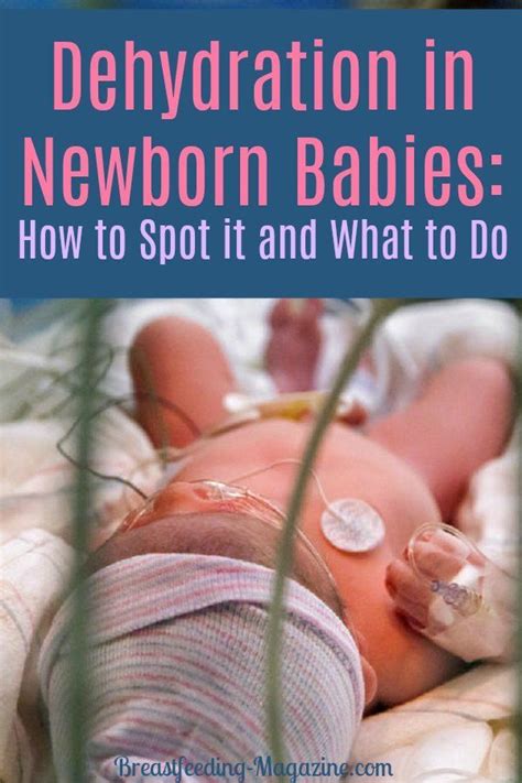 newborn dehydration signs
