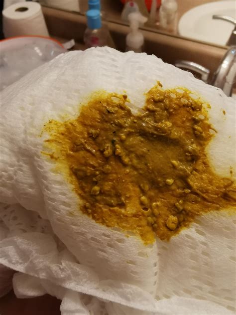 Newborn Poop and Diet