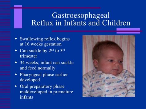 newborn reflux