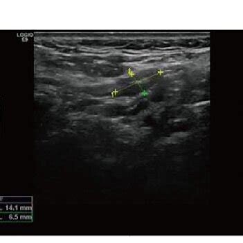 next steps after ultrasound image