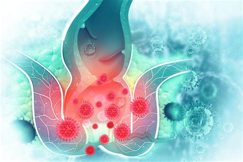Non-Surgical Alternatives for Hemorrhoid Treatment