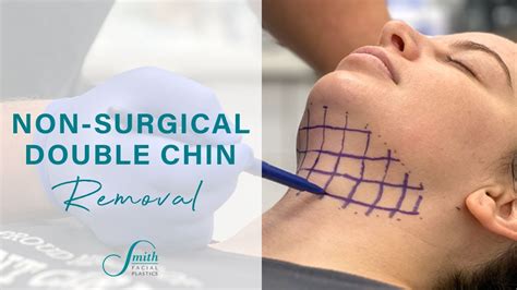 non-surgical removal