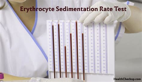 normal and abnormal results of sed rate sedimentation test