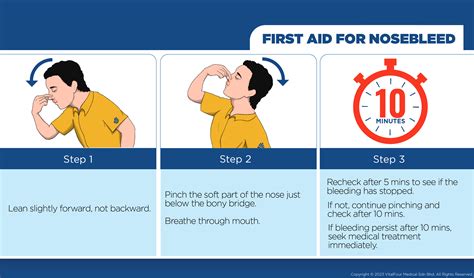 nosebleed medical treatments