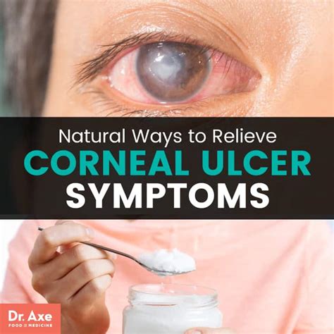 Nutritional Therapy for Eye Ulcers