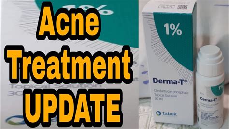 oral clindamycin acne treatment
