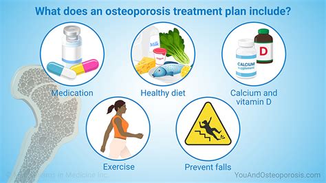 osteoporosis treatment