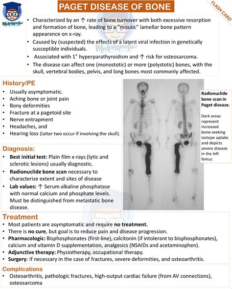 Conclusion on Paget's disease