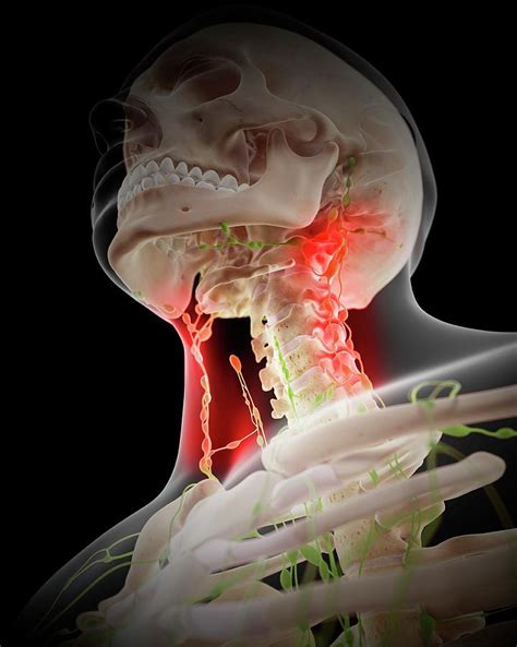 Painful Lymph Node Under Jaw