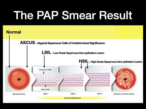 Pap Test Results
