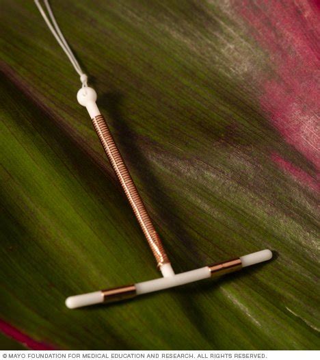 Paragard Copper T Fertility