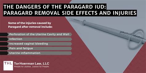Paragard Copper T Side Effects