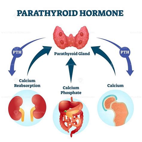 Parathyroid Hormone Imbalance