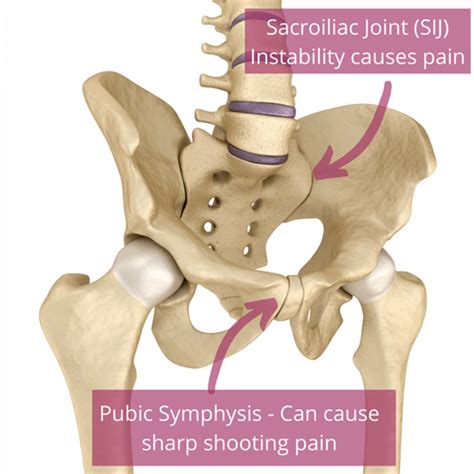 Pelvic Bone Pain After Pregnancy