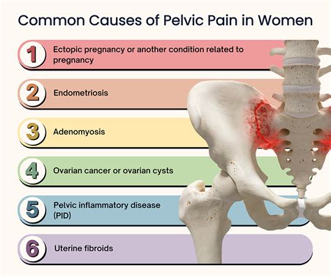 Pelvic Bone Pain Causes