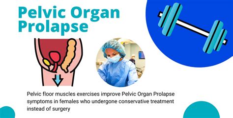 Pelvic Organ Prolapse Prevention