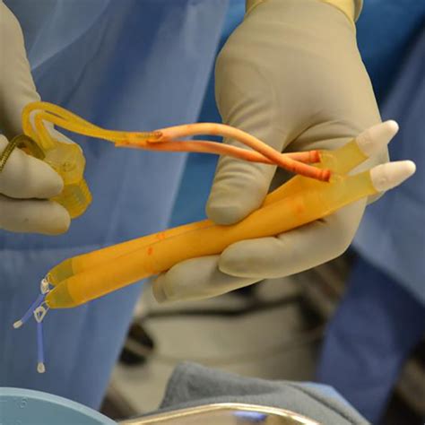 penile implant surgery