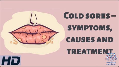 persistent cold causes