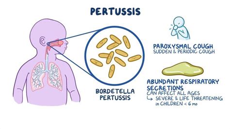 Pertussis causes