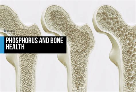 phosphorus and bone health