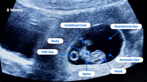 physical changes at 8 weeks pregnant