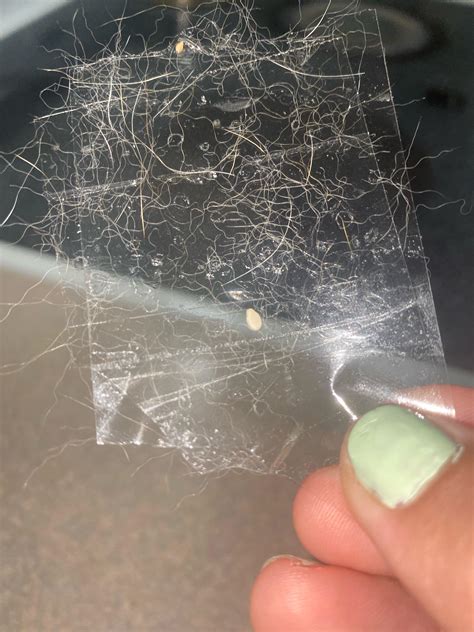 Pinworm eggs on tape