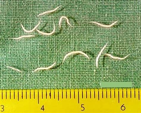 Pinworm Infection