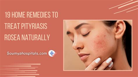 Pityriasis Rosea and Home Remedies