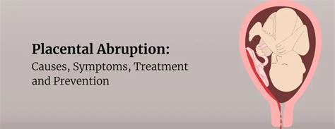 Placental Abruption Prevention