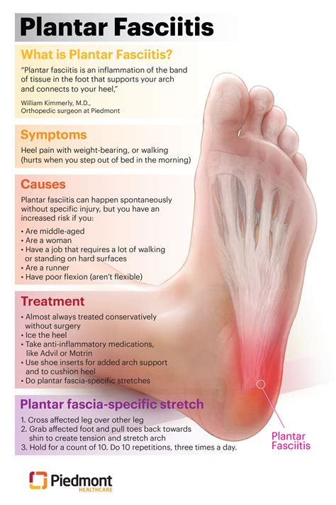 plantar fasciitis prevention
