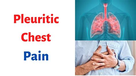 Pleuritic Chest Discomfort