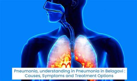 Pneumonia treatment outcomes