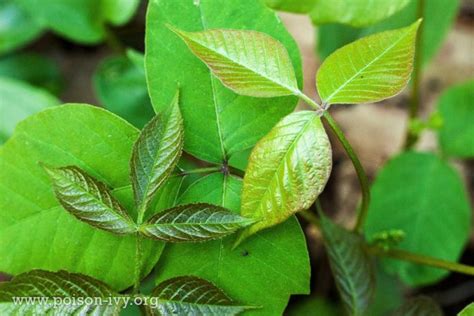 poison ivy complications