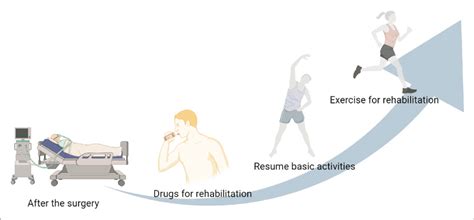 Post-Operative Rehabilitation